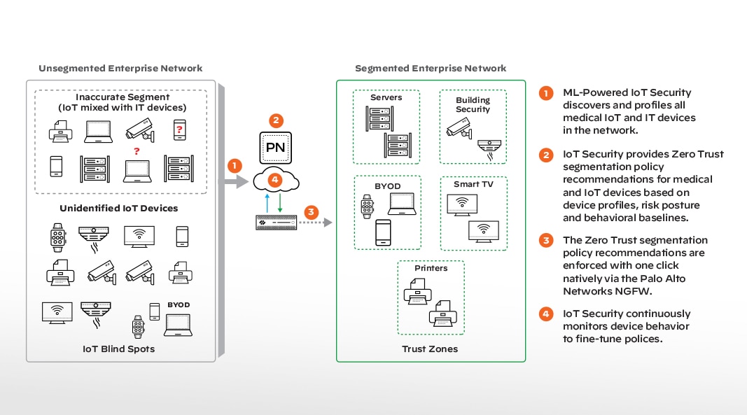 Eliminación de ángulos muertos de NAC